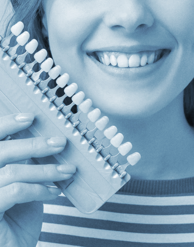 primo piano di ragazza sorridente che tiene in mano un set di faccette dentali